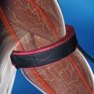 Bandes de réduction BFR