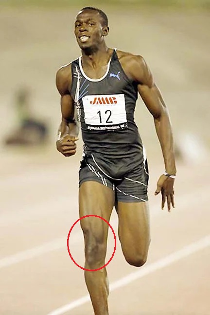 Les muscles quadriceps d'Usain Bolt