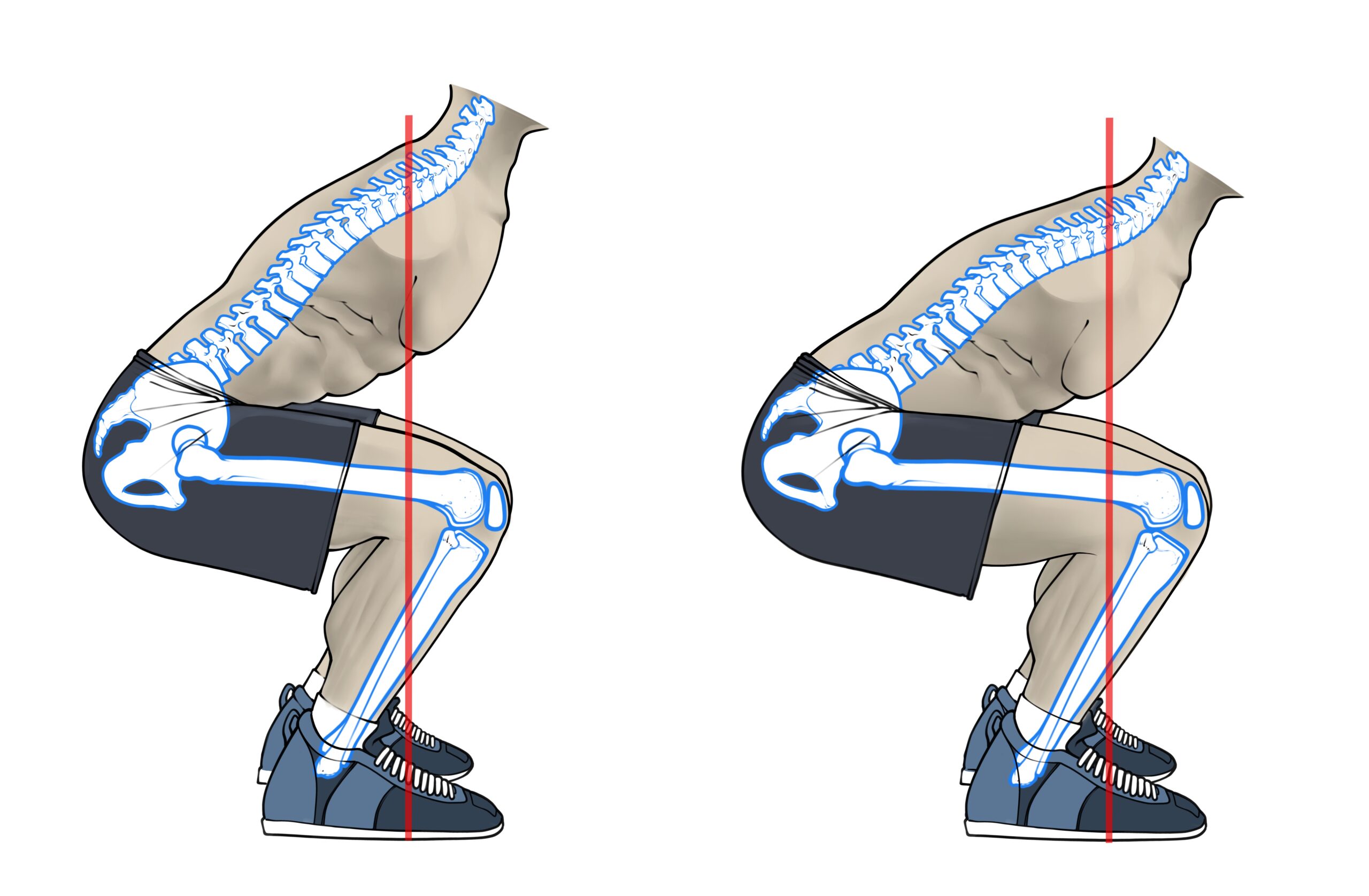 Fémurs longs et courts au squat